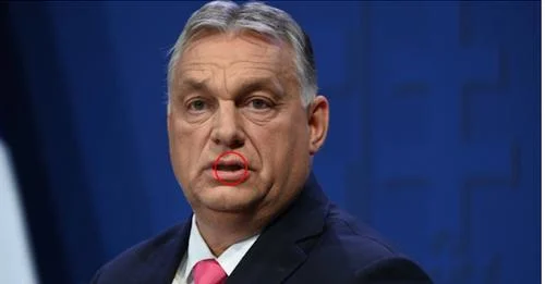 Nagyon aggódnak az emberek! Orbán Viktor EBBEN a súlyos betegségben szenved? Megszólalt egy orvos is. Ez a nagyon veszélyes folt van a száján már hosszú ideje..